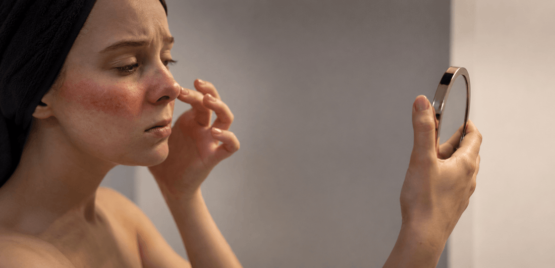 Woman examining redness and irritation on her cheek in a mirror, highlighting signs of a damaged skin barrier.