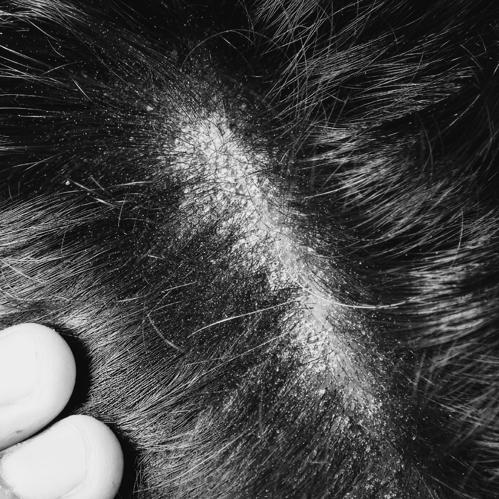 Scalp - bhisajyam.com